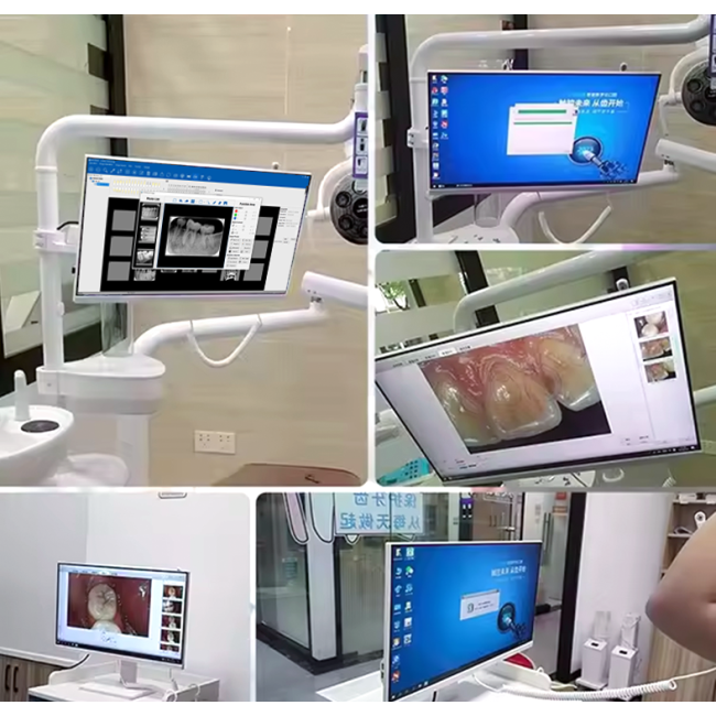 Dentalisches WLAN All-in-One-Intraorale Camera mit 24-Zoll-Touchscreen
